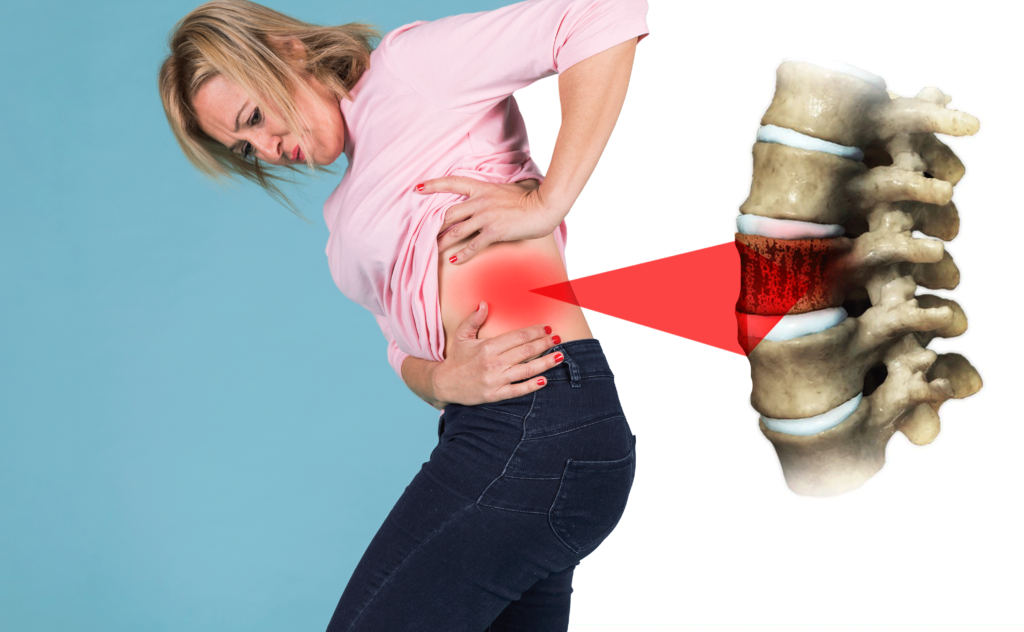 dolor crónico lumbar. Dolor de espalda. Dolor en la espalda baja. Ortopedia especializada Cirugia de columna